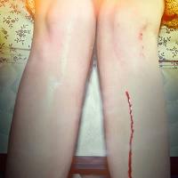 Vu de la mer par Los Campesinos